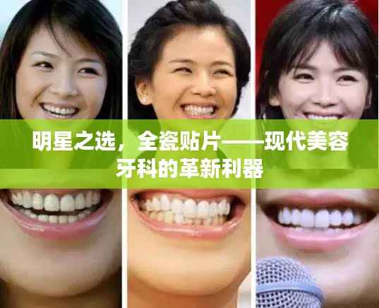 明星之选,全瓷贴片——现代美容牙科的革新利器
